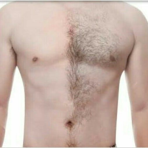 Depilação   masculina